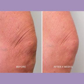 Magec Collagen Fullerene Neck Cream - Tightening & Anti-Wrinkle Formula